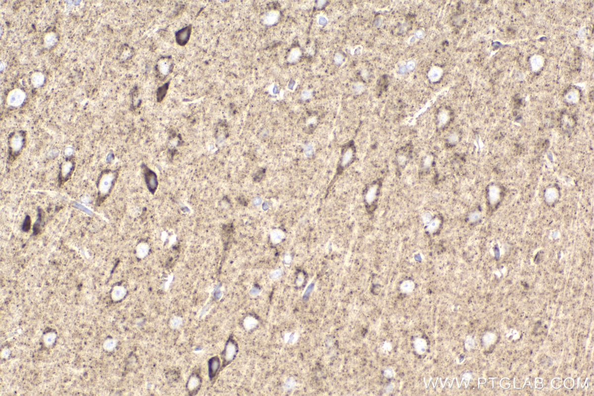 Immunohistochemical analysis of paraffin-embedded rat brain tissue slide using KHC2209 (UQCRC2 IHC Kit).