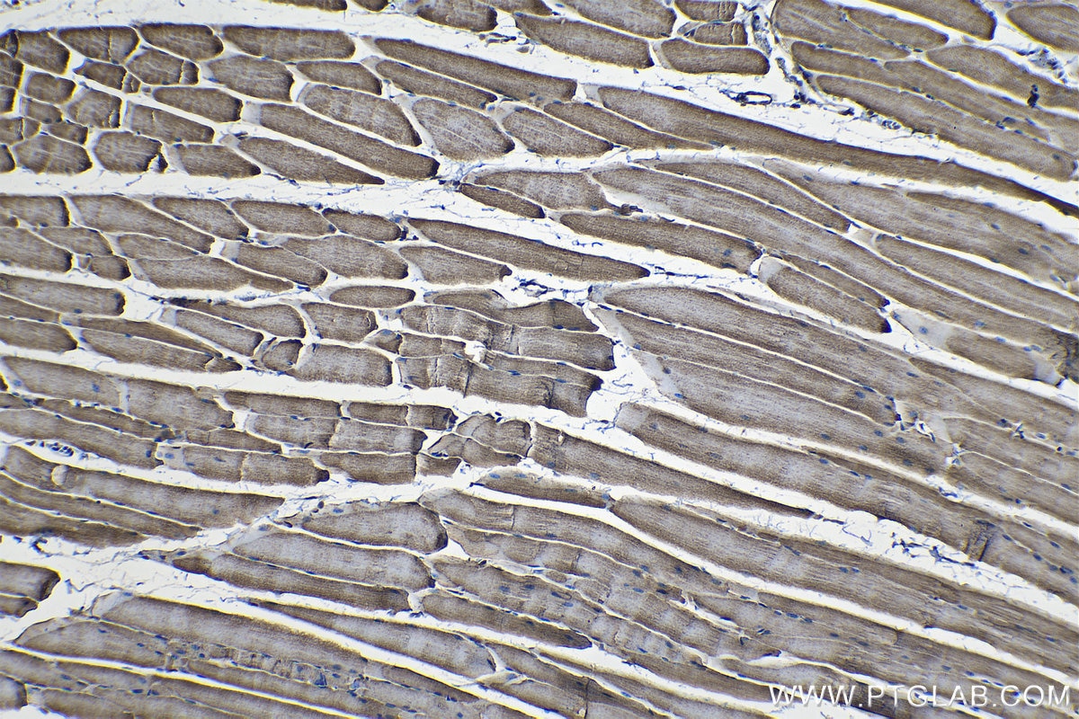 Immunohistochemical analysis of paraffin-embedded mouse skeletal muscle tissue slide using KHC1275 (UQCRFS1 IHC Kit).