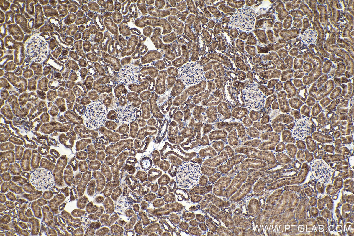 Immunohistochemical analysis of paraffin-embedded rat kidney tissue slide using KHC2165 (UQCRH IHC Kit).