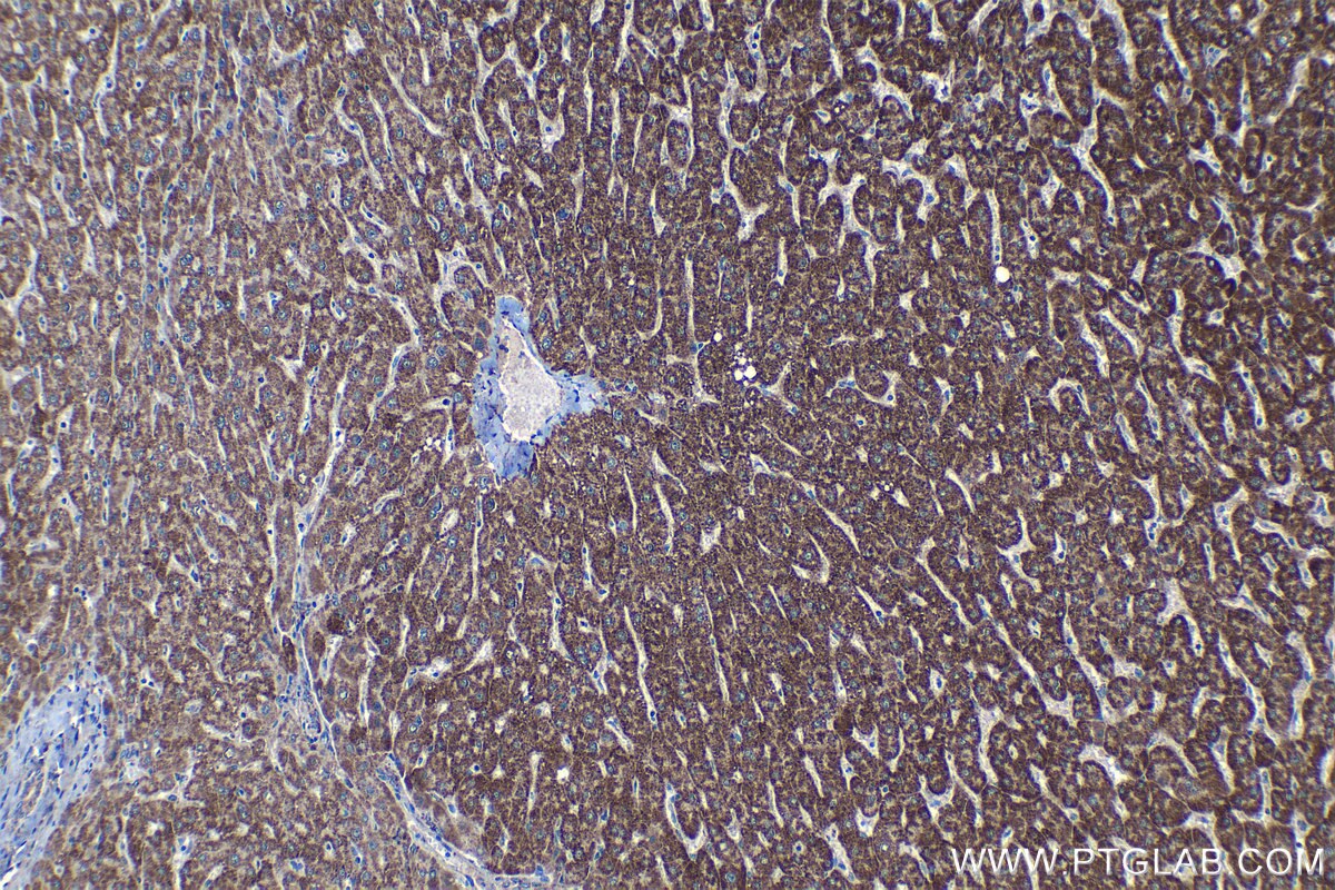 Immunohistochemical analysis of paraffin-embedded human liver tissue slide using KHC1374 (UQCRQ IHC Kit).