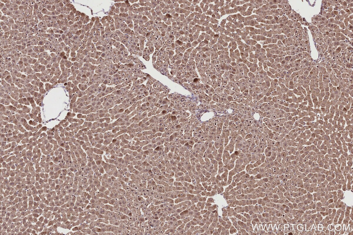 Immunohistochemical analysis of paraffin-embedded rat liver tissue slide using KHC2714 (URG4 IHC Kit).