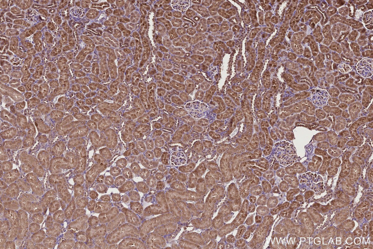 Immunohistochemical analysis of paraffin-embedded rat kidney tissue slide using KHC2714 (URG4 IHC Kit).