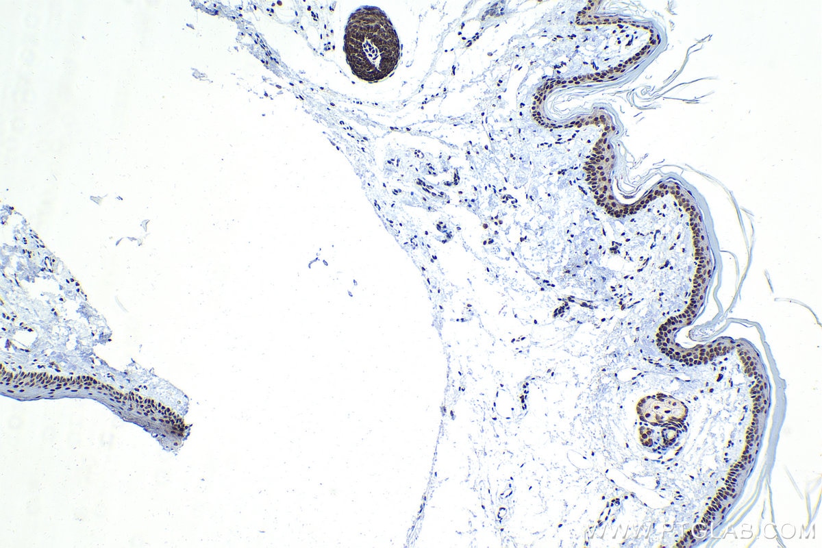 Immunohistochemical analysis of paraffin-embedded rat skin tissue slide using KHC1557 (USF1 IHC Kit).