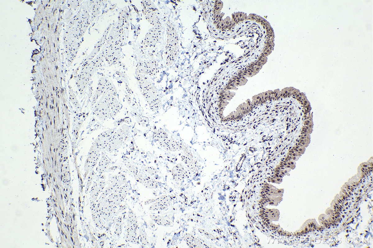 Immunohistochemical analysis of paraffin-embedded rat bladder tissue slide using KHC1557 (USF1 IHC Kit).