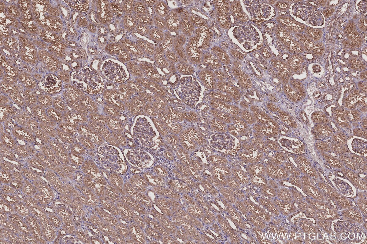 Immunohistochemical analysis of paraffin-embedded human kidney tissue slide using KHC3095 (USH1C IHC Kit). Immunohistochemical analysis of paraffin-embedded human kidney tissue slide using KHC3095 (USH1C IHC Kit).