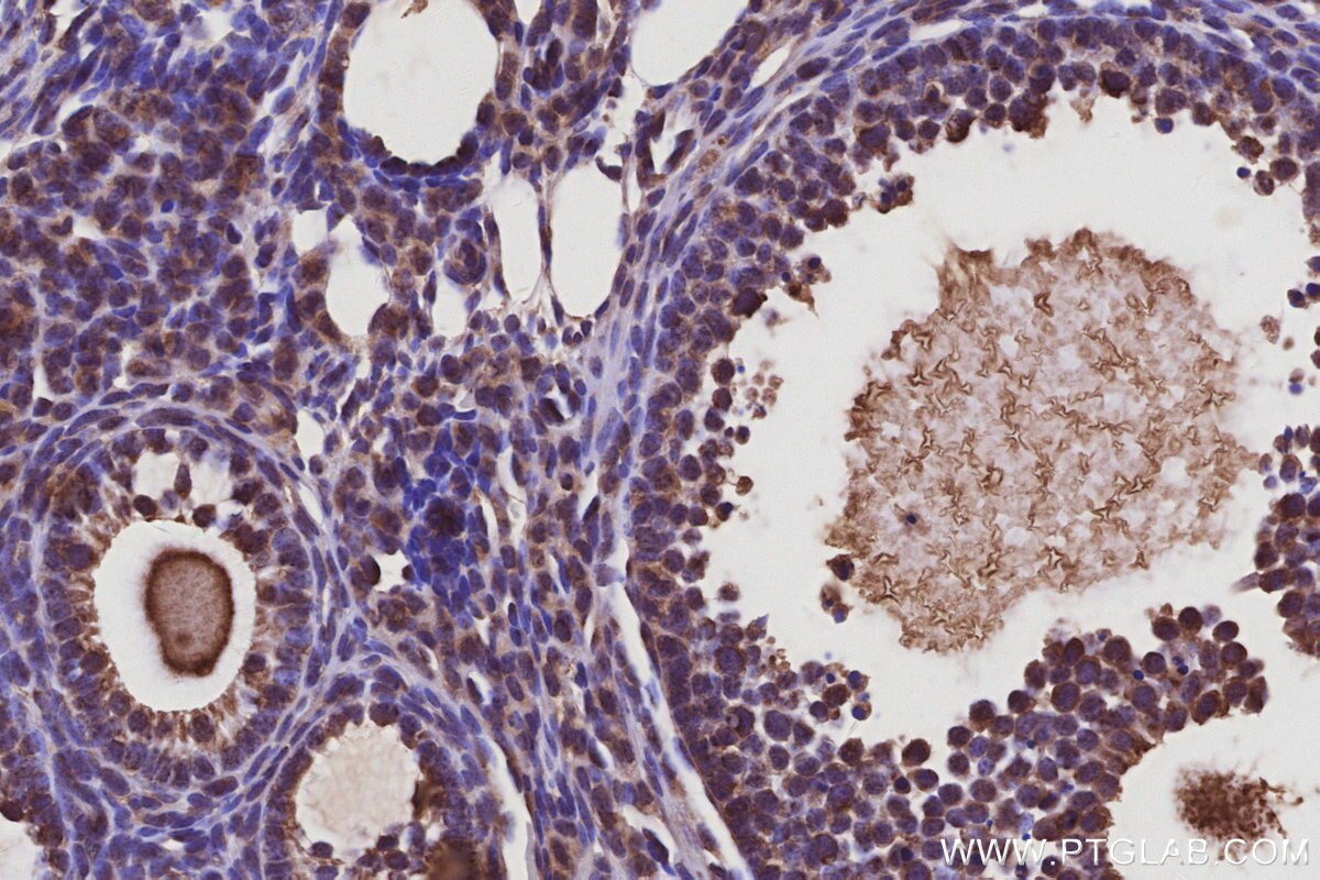 Immunohistochemical analysis of paraffin-embedded mouse ovary tissue slide using KHC3095 (USH1C IHC Kit). Immunohistochemical analysis of paraffin-embedded mouse ovary tissue slide using KHC3095 (USH1C IHC Kit).
