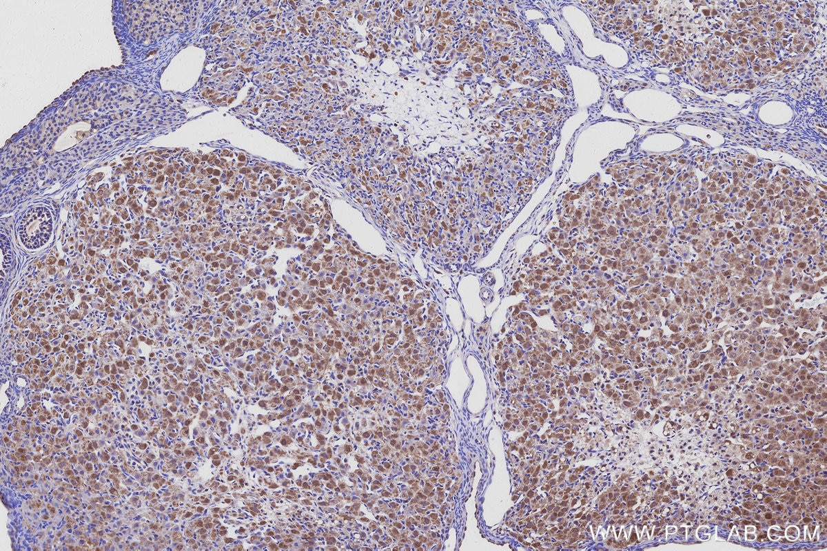 Immunohistochemical analysis of paraffin-embedded rat ovary tissue slide using KHC3095 (USH1C IHC Kit). Immunohistochemical analysis of paraffin-embedded rat ovary tissue slide using KHC3095 (USH1C IHC Kit).