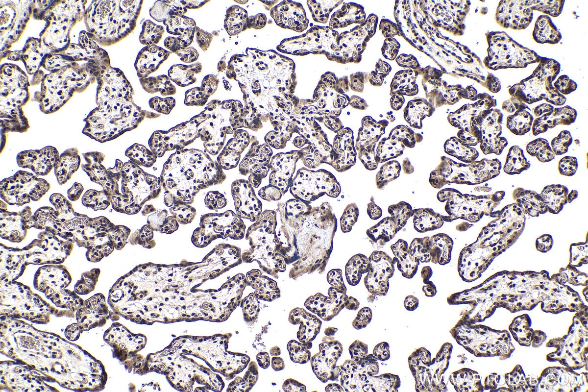 Immunohistochemical analysis of paraffin-embedded human placenta tissue slide using KHC1026 (USP11 IHC Kit).