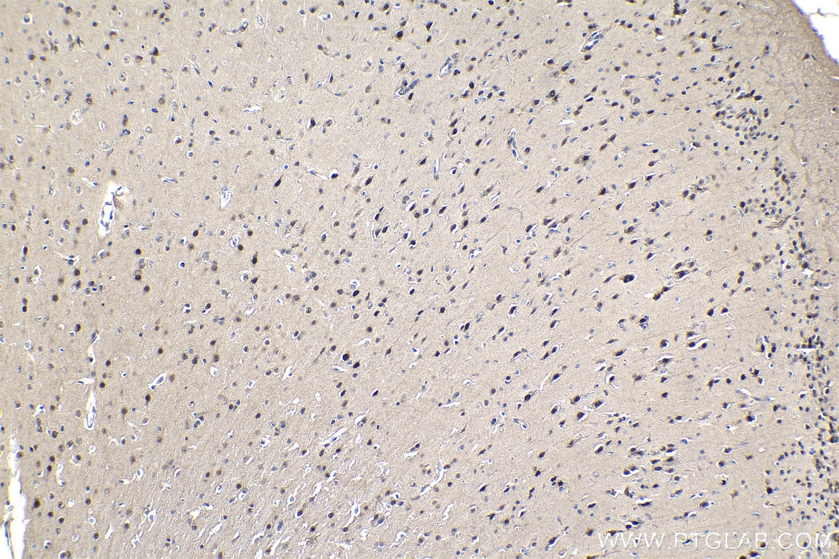 Immunohistochemical analysis of paraffin-embedded rat brain tissue slide using KHC1026 (USP11 IHC Kit).
