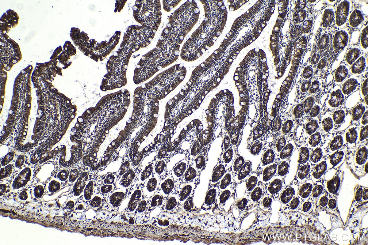 Immunohistochemical analysis of paraffin-embedded rat small intestine tissue slide using KHC2024 (USP15 IHC Kit).
