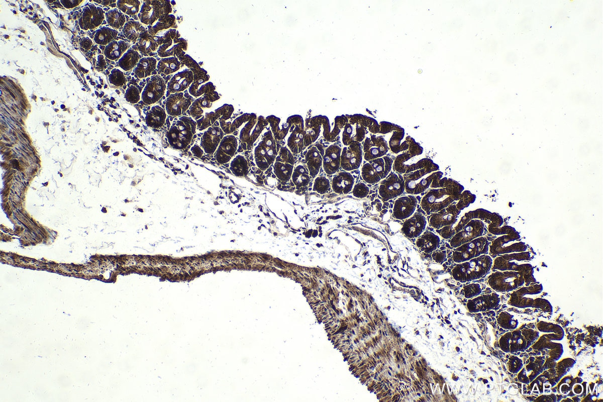 Immunohistochemical analysis of paraffin-embedded mouse small intestine tissue slide using KHC2024 (USP15 IHC Kit).