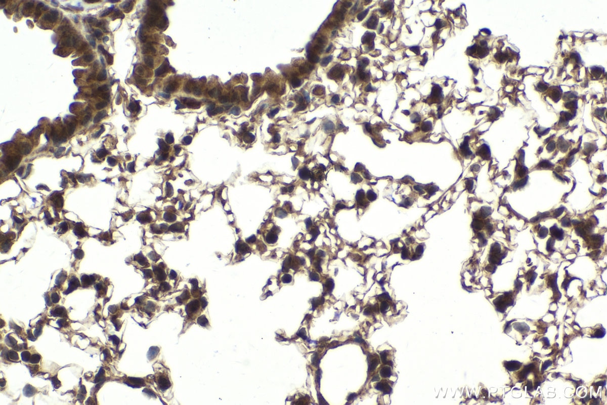 Immunohistochemical analysis of paraffin-embedded mouse lung tissue slide using KHC2024 (USP15 IHC Kit).