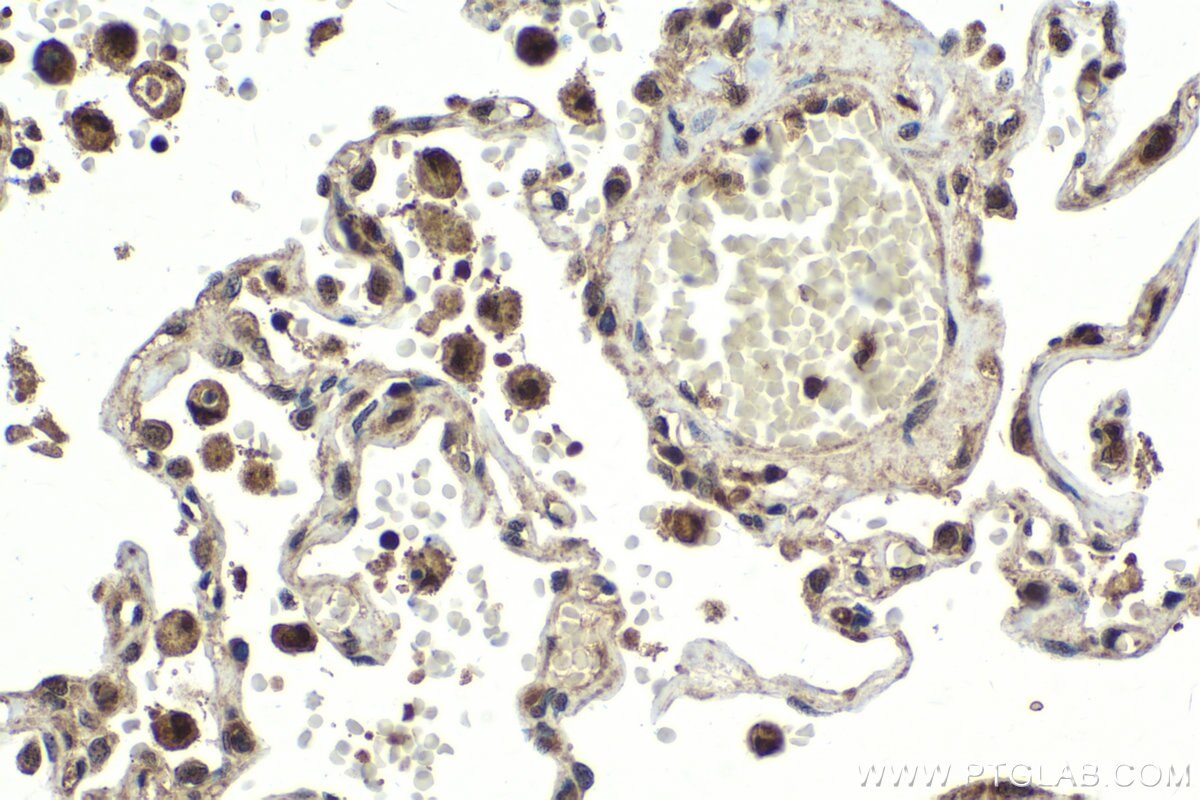 Immunohistochemical analysis of paraffin-embedded human lung tissue slide using KHC2024 (USP15 IHC Kit).