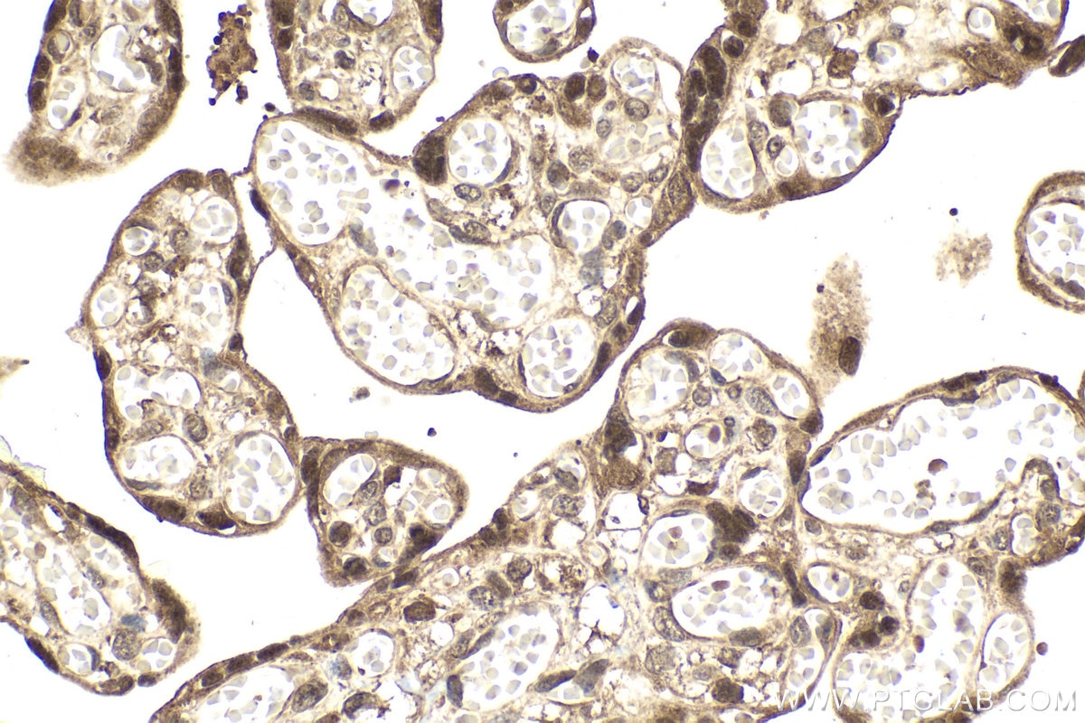 Immunohistochemical analysis of paraffin-embedded human placenta tissue slide using KHC2024 (USP15 IHC Kit).