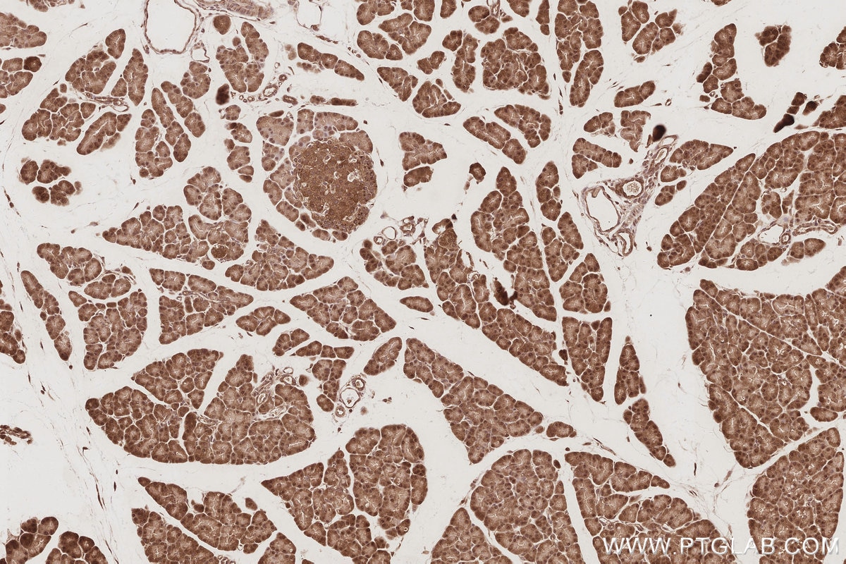 Immunohistochemical analysis of paraffin-embedded rat pancreas tissue slide using KHC3083 (USP16 IHC Kit). Immunohistochemical analysis of paraffin-embedded rat pancreas tissue slide using KHC3083 (USP16 IHC Kit).