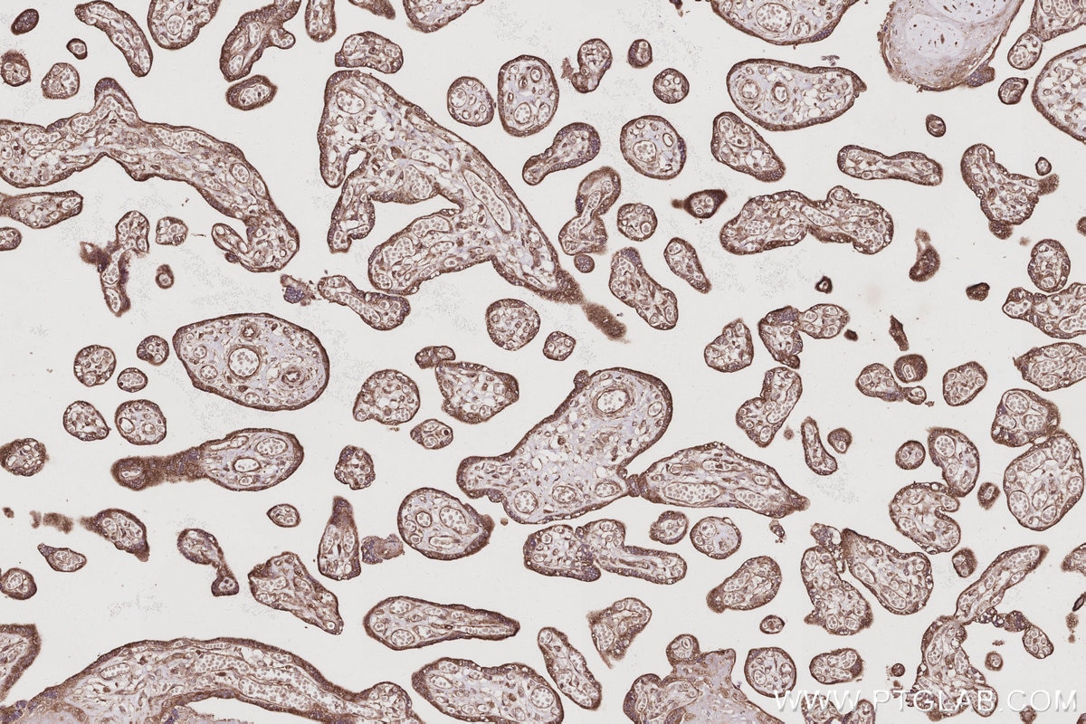 Immunohistochemical analysis of paraffin-embedded human placenta tissue slide using KHC3055 (USP20 IHC Kit). Immunohistochemical analysis of paraffin-embedded human placenta tissue slide using KHC3055 (USP20 IHC Kit).