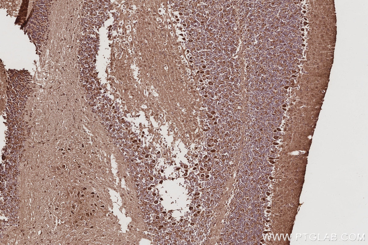 Immunohistochemical analysis of paraffin-embedded mouse cerebellum tissue slide using KHC3055 (USP20 IHC Kit). Immunohistochemical analysis of paraffin-embedded mouse cerebellum tissue slide using KHC3055 (USP20 IHC Kit).