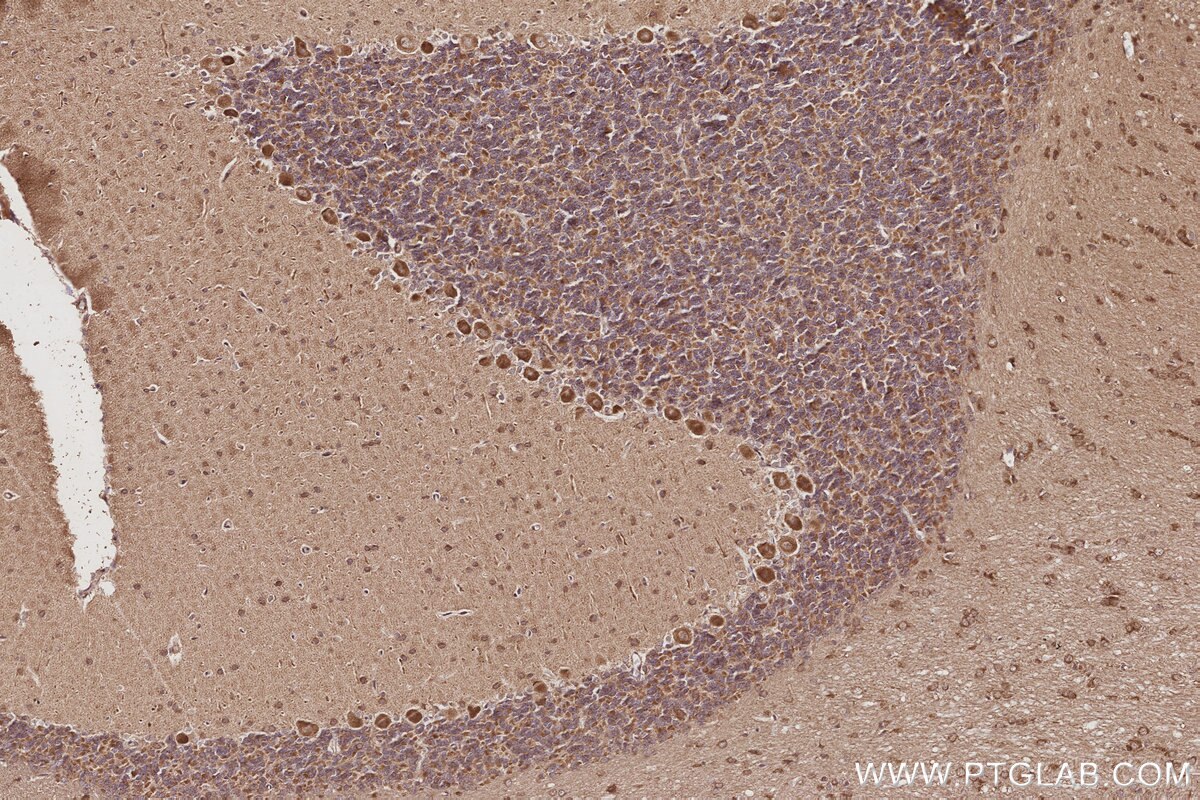 Immunohistochemical analysis of paraffin-embedded rat cerebellum tissue slide using KHC3055 (USP20 IHC Kit). Immunohistochemical analysis of paraffin-embedded rat cerebellum tissue slide using KHC3055 (USP20 IHC Kit).