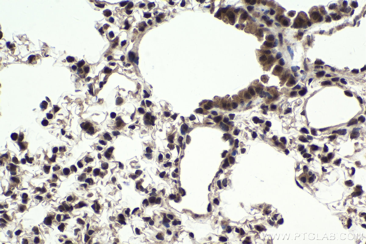 Immunohistochemical analysis of paraffin-embedded mouse lung tissue slide using KHC2009 (USP22 IHC Kit).