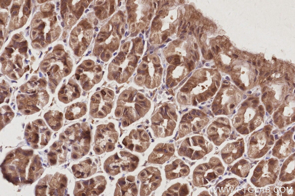 Immunohistochemical analysis of paraffin-embedded mouse stomach tissue slide using KHC3047 (USP24 IHC Kit). Immunohistochemical analysis of paraffin-embedded mouse stomach tissue slide using KHC3047 (USP24 IHC Kit).