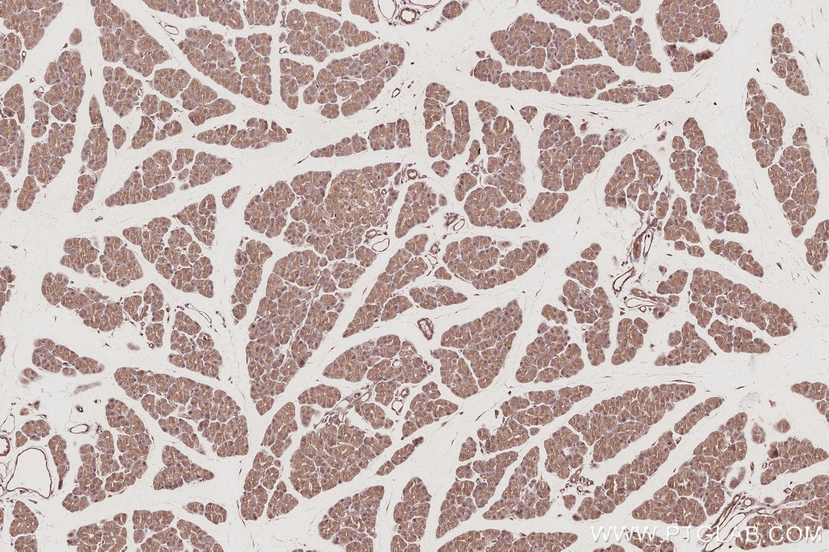 Immunohistochemical analysis of paraffin-embedded rat pancreas tissue slide using KHC3047 (USP24 IHC Kit). Immunohistochemical analysis of paraffin-embedded rat pancreas tissue slide using KHC3047 (USP24 IHC Kit).