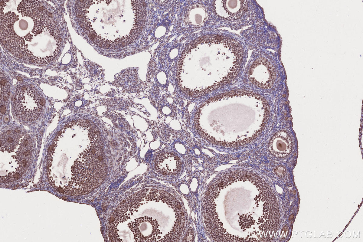 Immunohistochemical analysis of paraffin-embedded mouse ovary tissue slide using KHC2631 (USP37 IHC Kit).