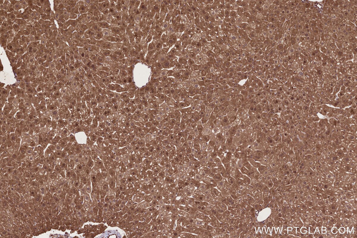 Immunohistochemical analysis of paraffin-embedded mouse liver tissue slide using KHC2685 (USP38 IHC Kit).