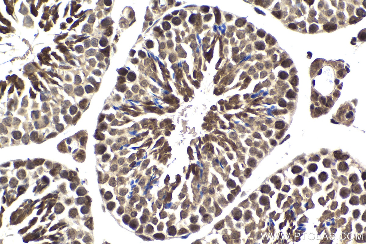 Immunohistochemical analysis of paraffin-embedded mouse testis tissue slide using KHC1863 (USP7 IHC Kit).