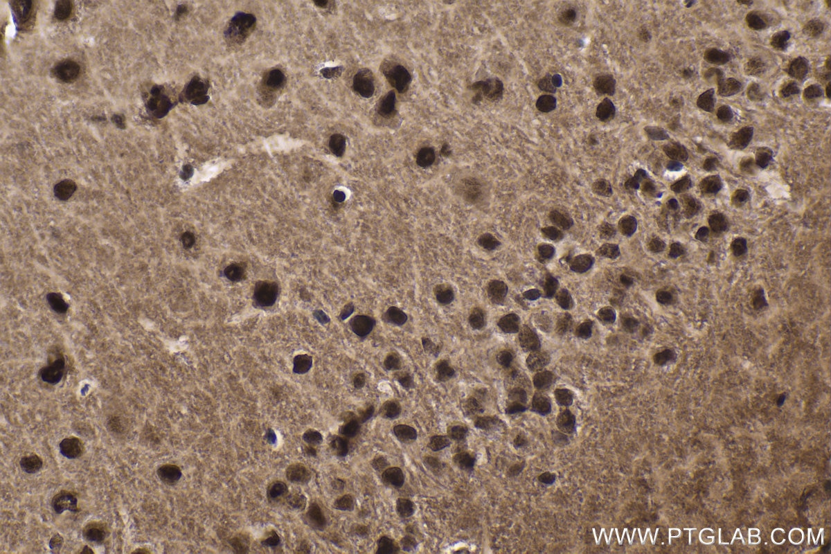 Immunohistochemical analysis of paraffin-embedded mouse brain tissue slide using KHC1863 (USP7 IHC Kit).