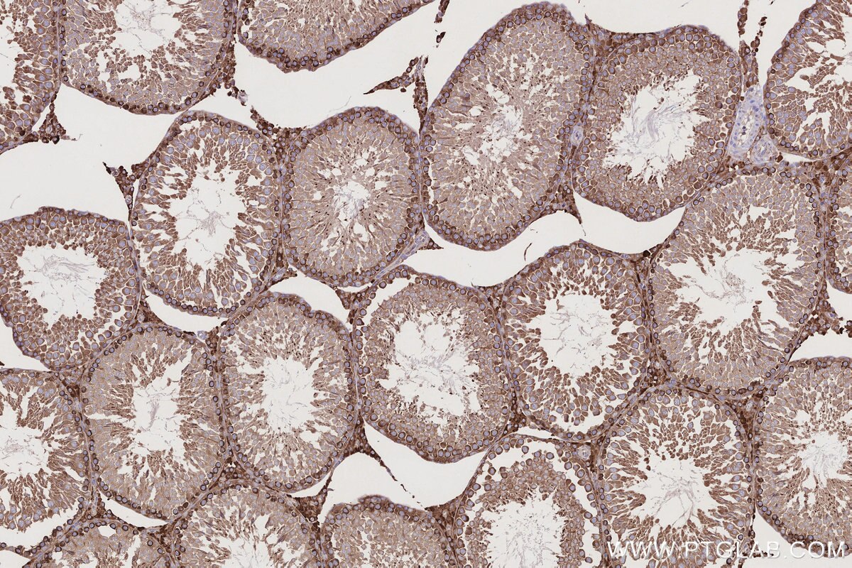 Immunohistochemical analysis of paraffin-embedded rat testis tissue slide using KHC2770 (USP9X IHC Kit).