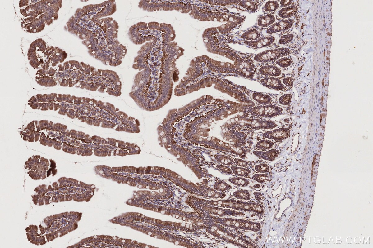 Immunohistochemical analysis of paraffin-embedded rat small intestine tissue slide using KHC2770 (USP9X IHC Kit).