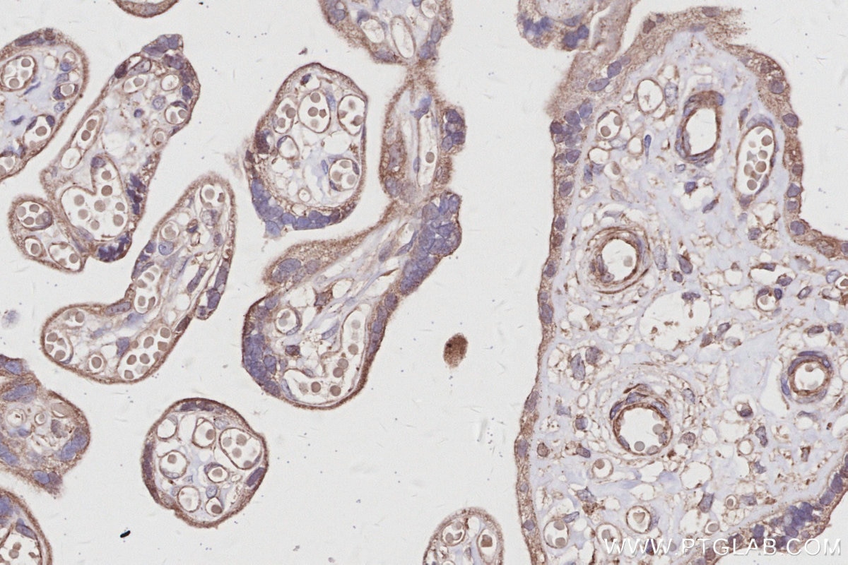 Immunohistochemical analysis of paraffin-embedded human placenta tissue slide using KHC2997 (UVRAG IHC Kit).