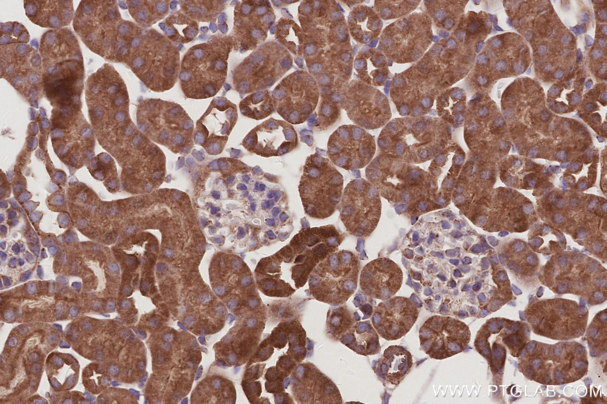 Immunohistochemical analysis of paraffin-embedded mouse kidney tissue slide using KHC2997 (UVRAG IHC Kit).