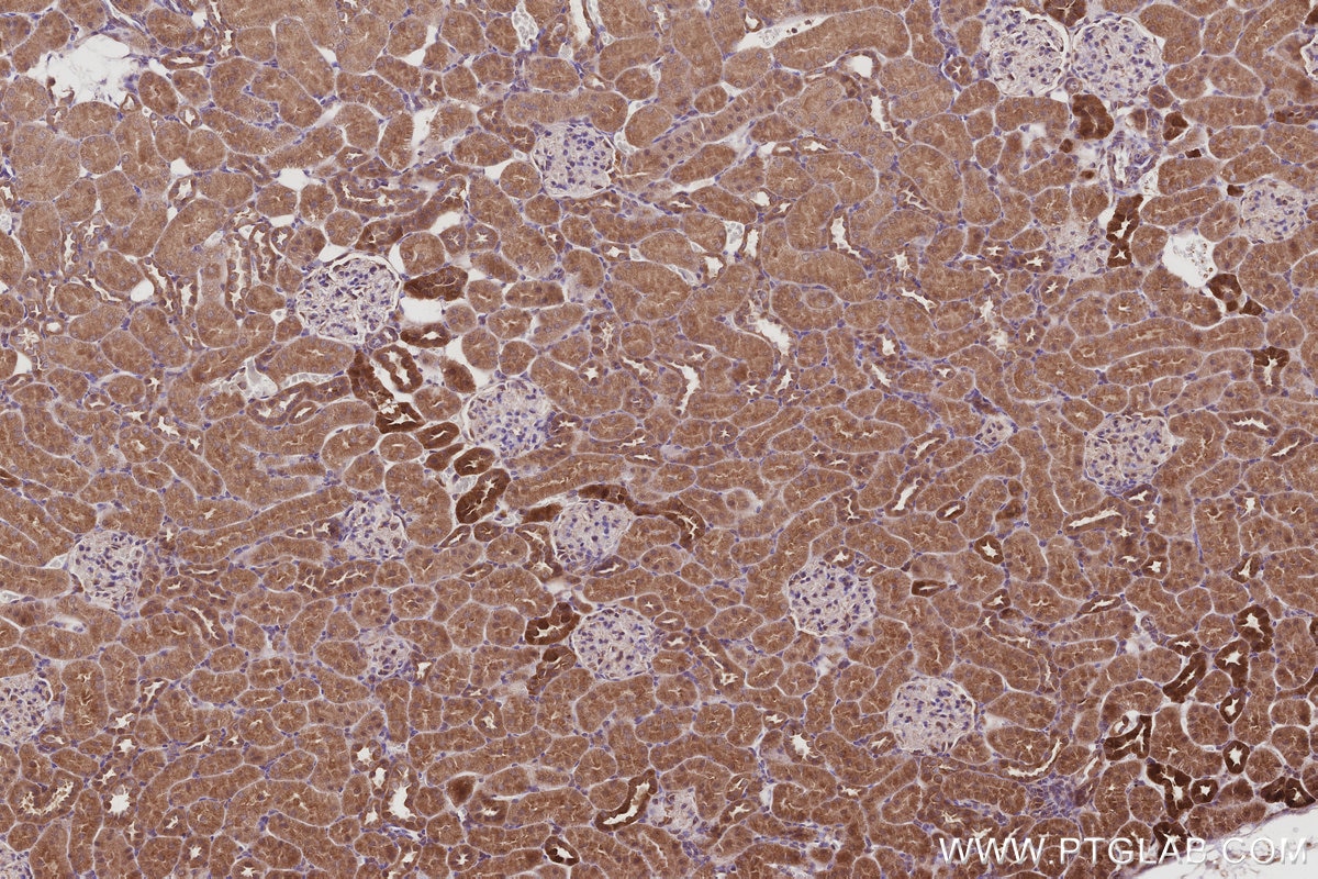 Immunohistochemical analysis of paraffin-embedded rat kidney tissue slide using KHC2997 (UVRAG IHC Kit).