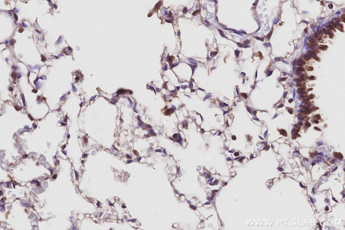 Immunohistochemical analysis of paraffin-embedded rat lung tissue slide using KHC2997 (UVRAG IHC Kit).
