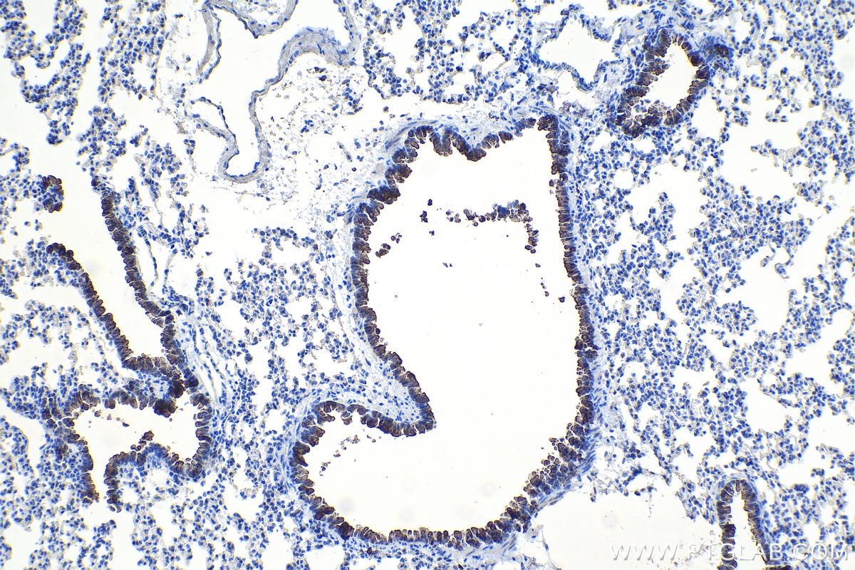 Immunohistochemical analysis of paraffin-embedded mouse lung tissue slide using KHC1091 (Uteroglobin/SCGB1A1 IHC Kit).