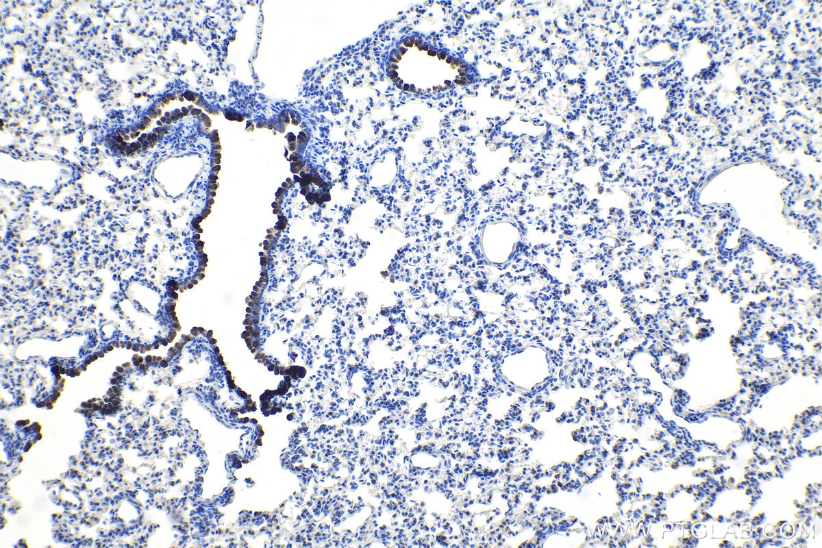Immunohistochemical analysis of paraffin-embedded rat lung tissue slide using KHC1091 (Uteroglobin/SCGB1A1 IHC Kit).