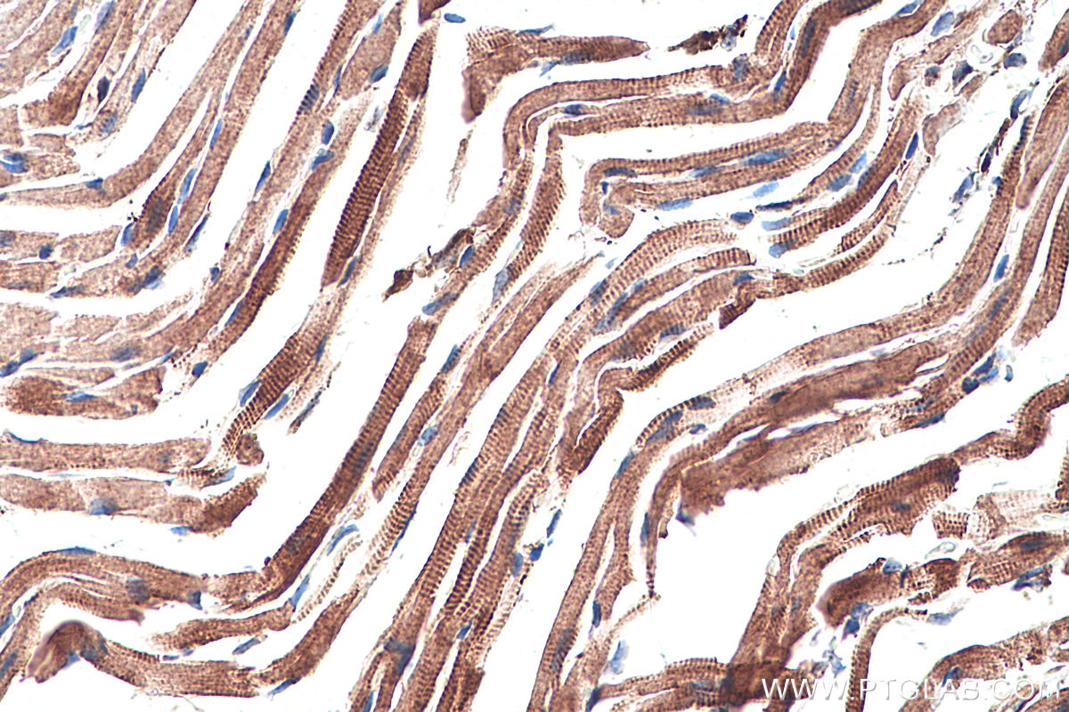 Immunohistochemical analysis of paraffin-embedded mouse heart tissue slide using KHC0289 (Utrophin IHC Kit).