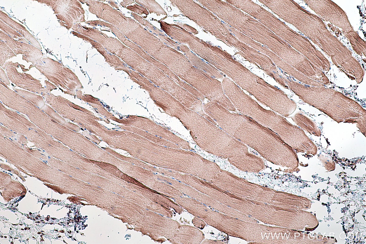 Immunohistochemical analysis of paraffin-embedded rat skeletal muscle tissue slide using KHC0289 (Utrophin IHC Kit).