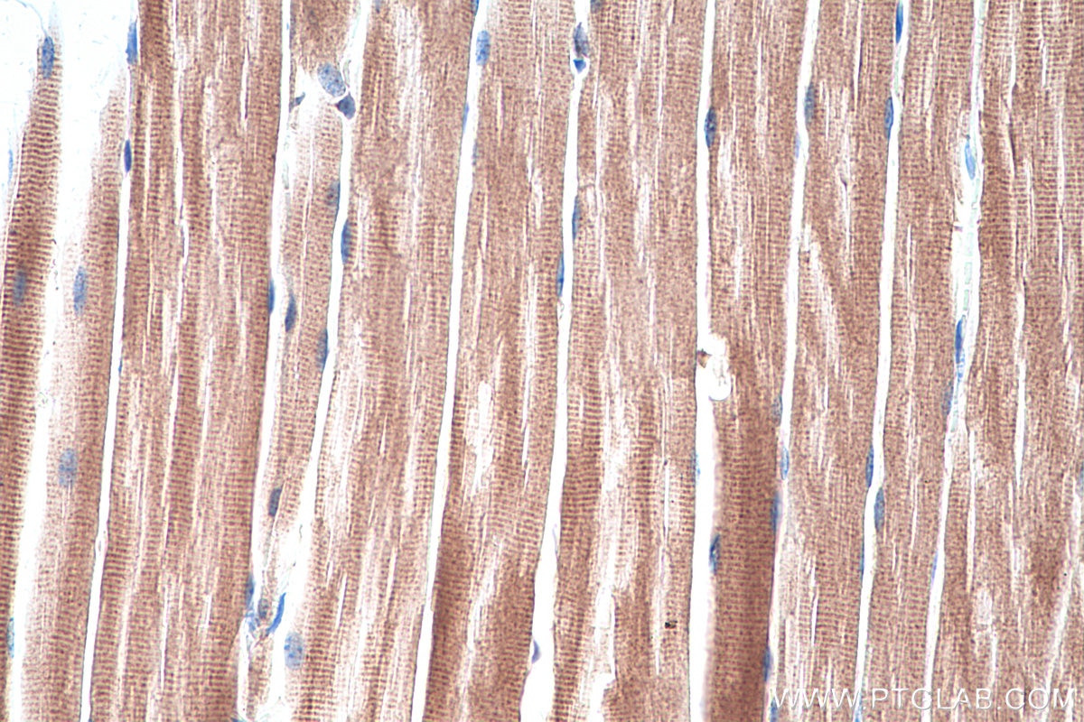 Immunohistochemical analysis of paraffin-embedded mouse skeletal muscle tissue slide using KHC0289 (Utrophin IHC Kit).