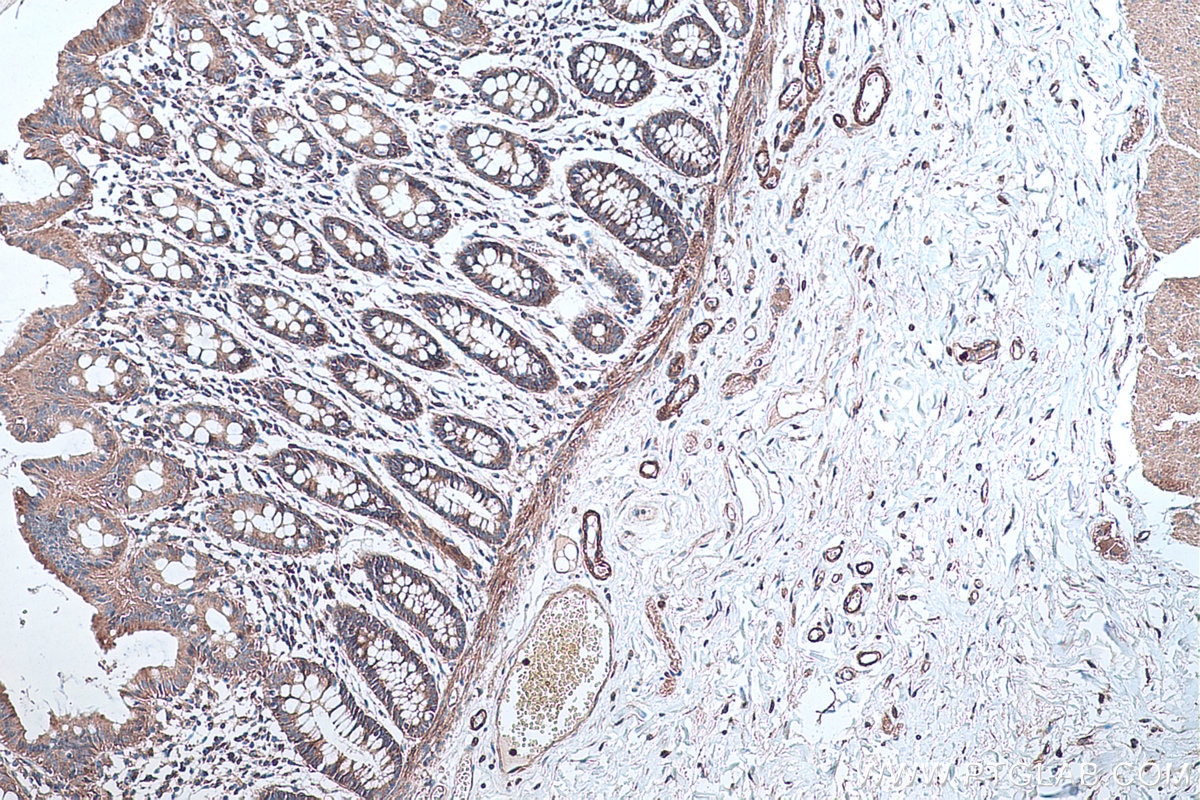 Immunohistochemical analysis of paraffin-embedded human colon tissue slide using KHC0289 (Utrophin IHC Kit).