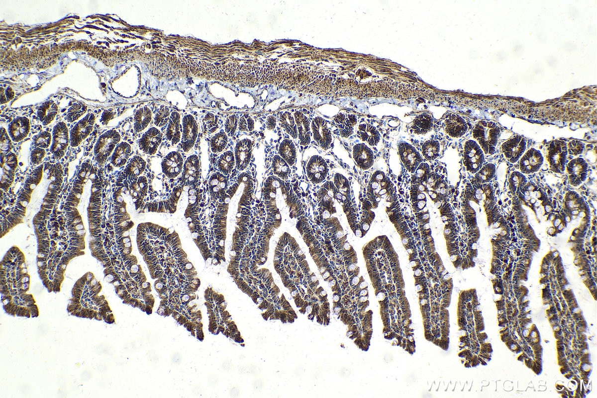 Immunohistochemical analysis of paraffin-embedded rat small intestine tissue slide using KHC2110 (VAMP4 IHC Kit).