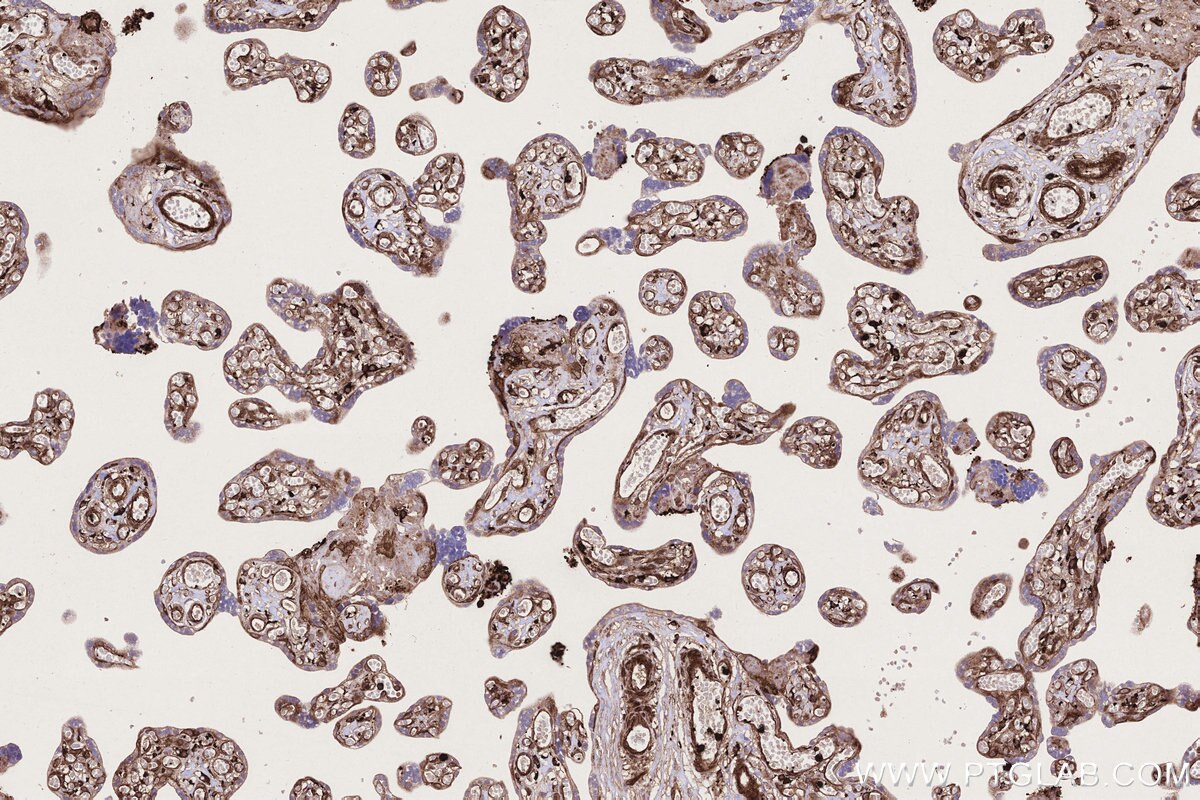 Immunohistochemical analysis of paraffin-embedded human placenta tissue slide using KHC3220 (VASP IHC Kit). Immunohistochemical analysis of paraffin-embedded human placenta tissue slide using KHC3220 (VASP IHC Kit).
