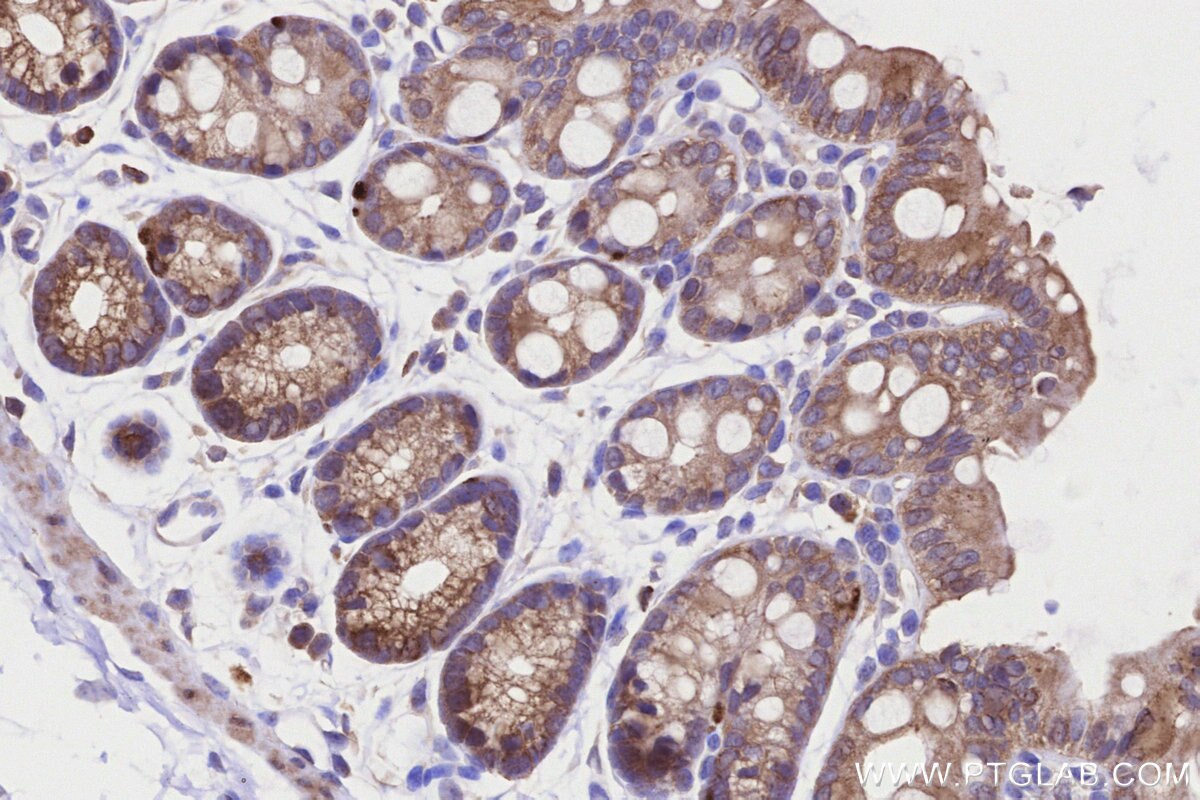 Immunohistochemical analysis of paraffin-embedded mouse colon tissue slide using KHC3220 (VASP IHC Kit). Immunohistochemical analysis of paraffin-embedded mouse colon tissue slide using KHC3220 (VASP IHC Kit).