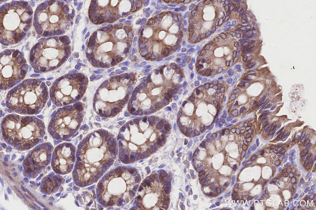Immunohistochemical analysis of paraffin-embedded rat colon tissue slide using KHC3220 (VASP IHC Kit). Immunohistochemical analysis of paraffin-embedded rat colon tissue slide using KHC3220 (VASP IHC Kit).