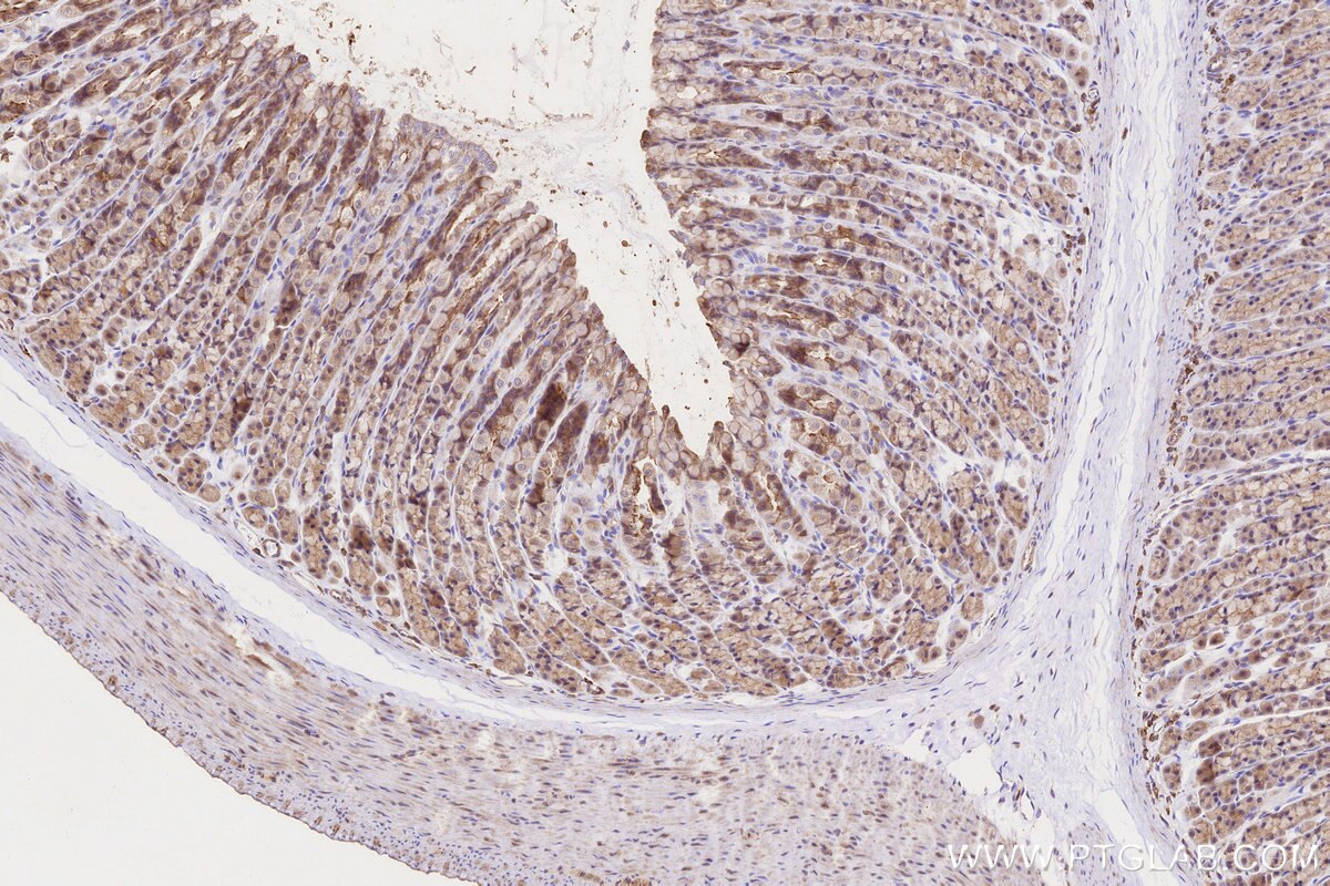Immunohistochemical analysis of paraffin-embedded rat stomach tissue slide using KHC3220 (VASP IHC Kit). Immunohistochemical analysis of paraffin-embedded rat stomach tissue slide using KHC3220 (VASP IHC Kit).