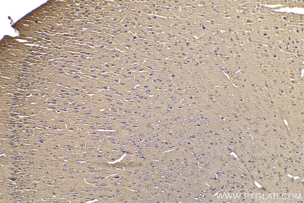 Immunohistochemical analysis of paraffin-embedded rat brain tissue slide using KHC0944 (VBP1 IHC Kit).