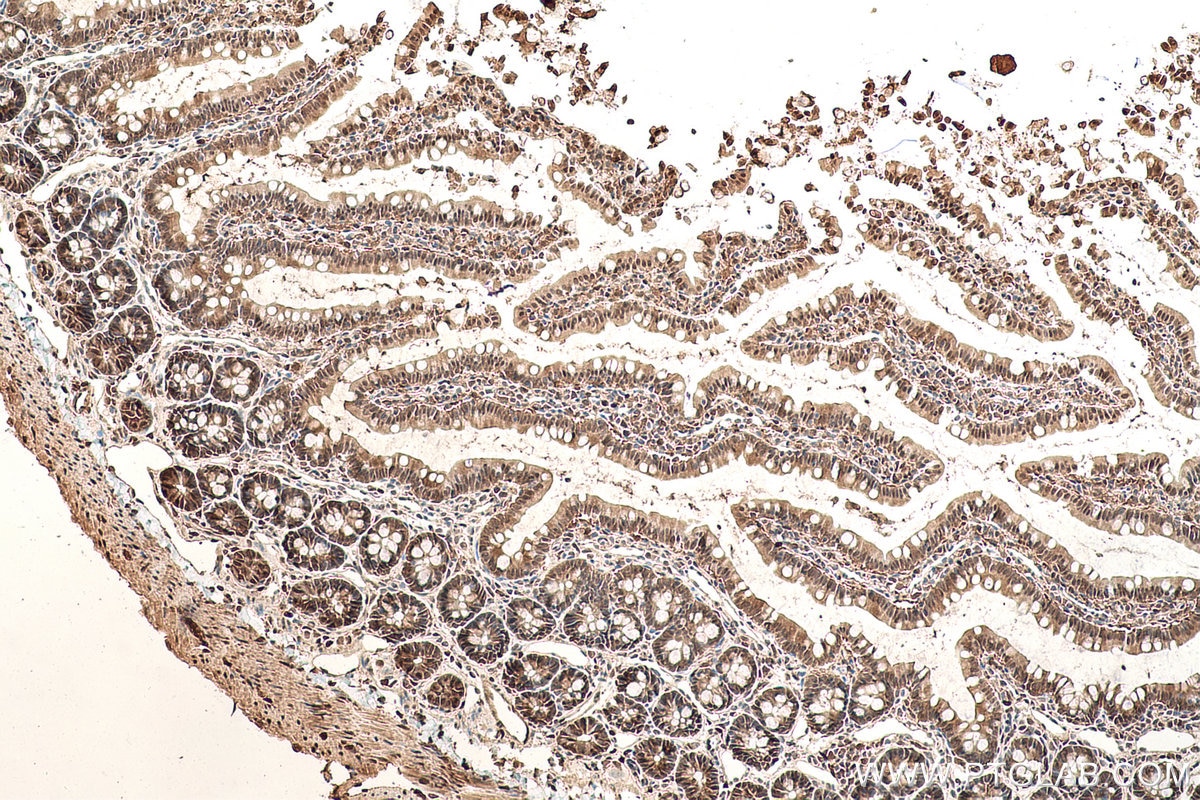 Immunohistochemical analysis of paraffin-embedded rat small intestine tissue slide using KHC0830 (VCP IHC Kit).