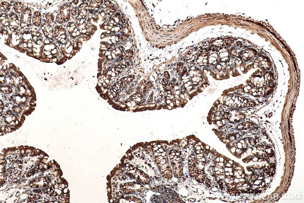Immunohistochemical analysis of paraffin-embedded mouse colon tissue slide using KHC0830 (VCP IHC Kit).