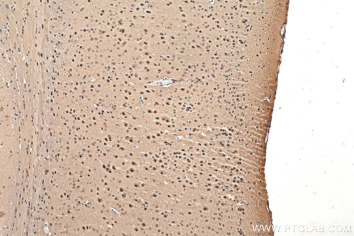 Immunohistochemical analysis of paraffin-embedded mouse brain tissue slide using KHC0830 (VCP IHC Kit).